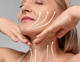 Minilifting facial en Barcelona