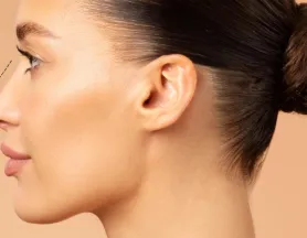 Rinoplastia en Barcelona