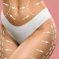 Liposucción corporal en Barcelona