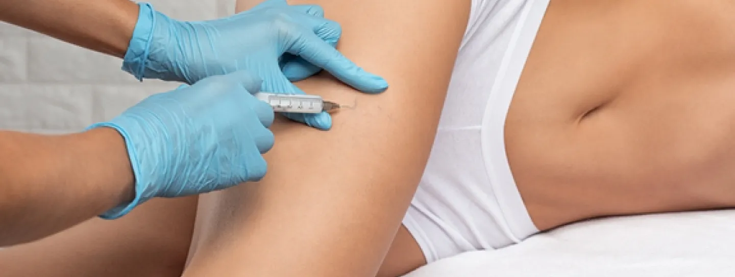 Escleroterapia en Barcelona