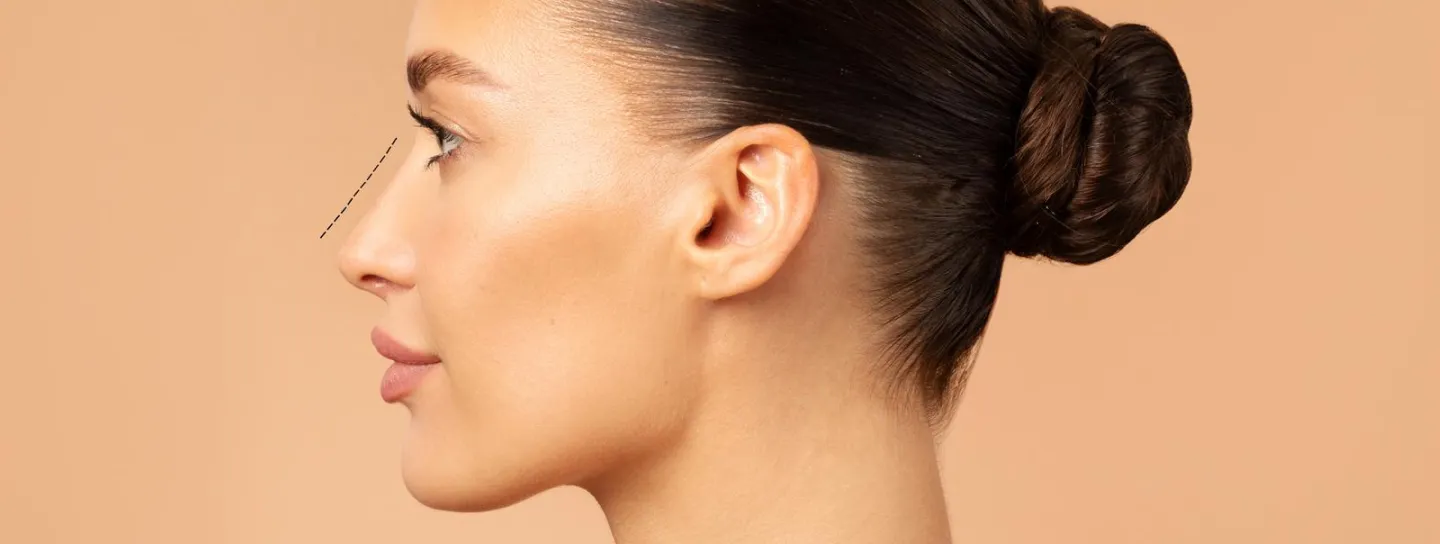 Rinoplastia en Barcelona