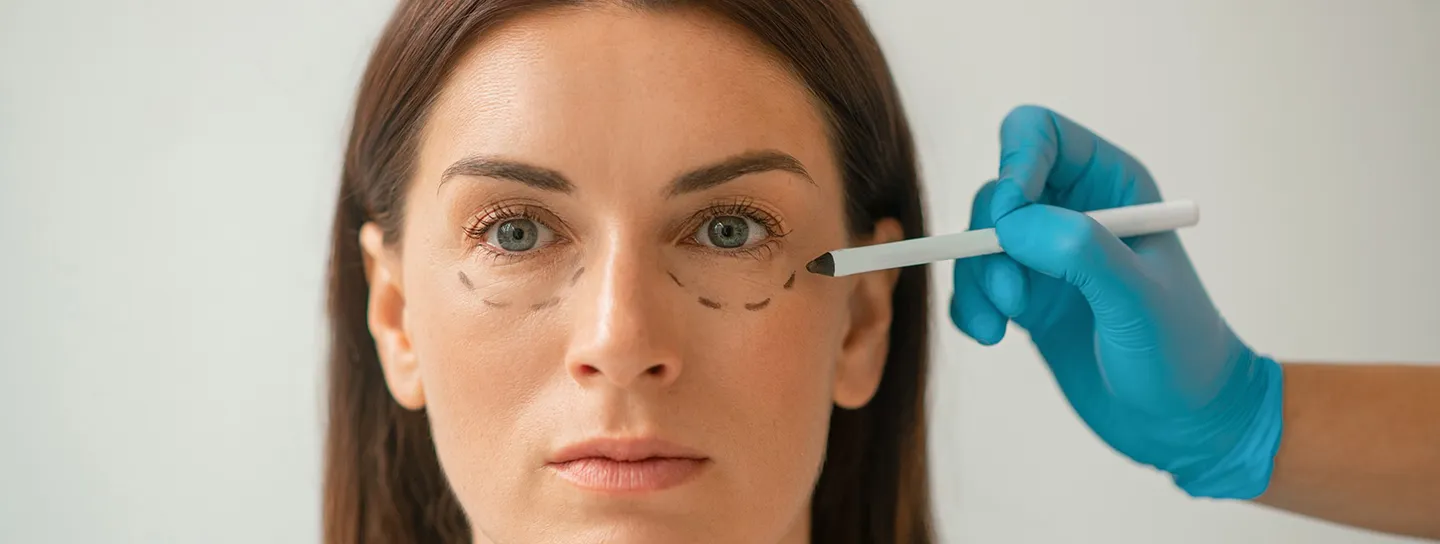 Blefaroplastia en Barcelona