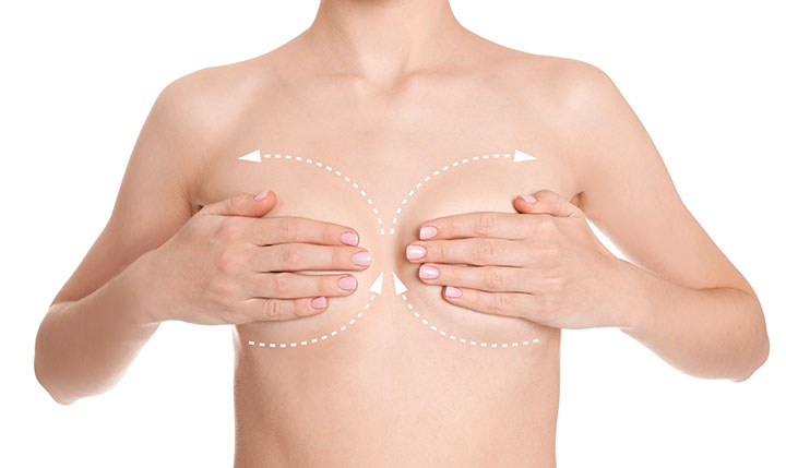Cirugía-estética-mamoplastia-de-aumento